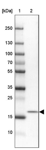 MORN4 Antibody in Western Blot (WB)