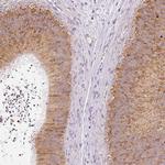 MORN4 Polyclonal Antibody