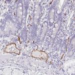 EHD4 Antibody in Immunohistochemistry (Paraffin) (IHC (P))