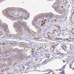 EHD4 Antibody in Immunohistochemistry (Paraffin) (IHC (P))
