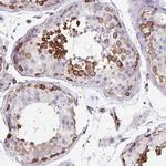 EHD4 Antibody in Immunohistochemistry (Paraffin) (IHC (P))