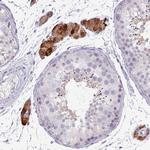 ZNF878 Antibody in Immunohistochemistry (Paraffin) (IHC (P))