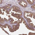 CENPBD1 Polyclonal Antibody