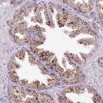 V-ATPase E2 Polyclonal Antibody