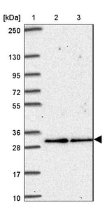 V-ATPase E2 Antibody in Western Blot (WB)