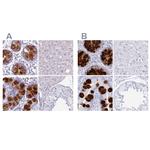 CLCA1 Antibody in Immunohistochemistry (IHC)