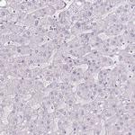 CLCA1 Antibody in Immunohistochemistry (IHC)