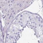 CLCA1 Antibody in Immunohistochemistry (IHC)