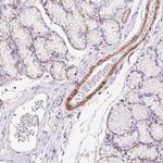SUSD5 Polyclonal Antibody