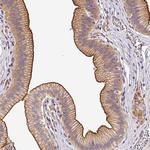 OR11H4 Polyclonal Antibody