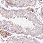 PAQR9 Antibody in Immunohistochemistry (IHC)