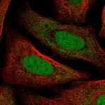 TMEM215 Polyclonal Antibody