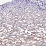 NCCRP1 Antibody in Immunohistochemistry (IHC)