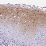 NCCRP1 Antibody in Immunohistochemistry (IHC)