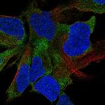 FAT4 Polyclonal Antibody