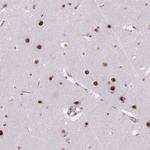 C2orf82 Antibody in Immunohistochemistry (Paraffin) (IHC (P))
