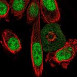 C2orf82 Polyclonal Antibody