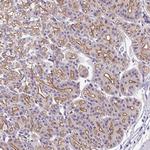 IQCJ Polyclonal Antibody