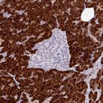 RGS21 Polyclonal Antibody