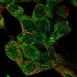 GLDC Polyclonal Antibody