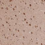 C6orf163 Antibody in Immunohistochemistry (Paraffin) (IHC (P))