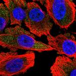 ATP8A1 Polyclonal Antibody