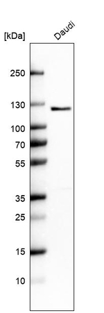 ATP8A1 Antibody in Western Blot (WB)