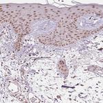 THOC6 Antibody in Immunohistochemistry (Paraffin) (IHC (P))