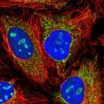 NACC2 Polyclonal Antibody