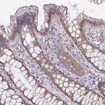 NACC2 Antibody in Immunohistochemistry (Paraffin) (IHC (P))