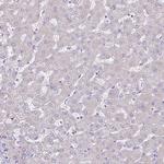 COL17A1 Antibody in Immunohistochemistry (Paraffin) (IHC (P))