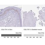 COL17A1 Antibody in Immunohistochemistry (IHC)