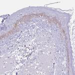 COL17A1 Antibody in Immunohistochemistry (IHC)