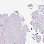 COL17A1 Antibody in Immunohistochemistry (IHC)