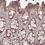 TWEAK Antibody in Immunohistochemistry (Paraffin) (IHC (P))