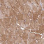 TWEAK Antibody in Immunohistochemistry (Paraffin) (IHC (P))