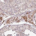 TWEAK Antibody in Immunohistochemistry (Paraffin) (IHC (P))