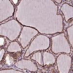 POLR2G Antibody in Immunohistochemistry (Paraffin) (IHC (P))