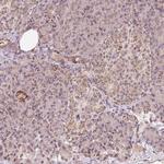 ZNF460 Antibody in Immunohistochemistry (Paraffin) (IHC (P))