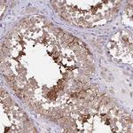 CFAP97D1 Antibody in Immunohistochemistry (Paraffin) (IHC (P))