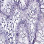ZPBP2 Antibody in Immunohistochemistry (IHC)