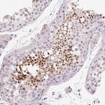 LYZL6 Polyclonal Antibody