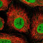 ORP7 Polyclonal Antibody