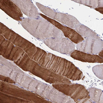 ORP7 Antibody in Immunohistochemistry (Paraffin) (IHC (P))