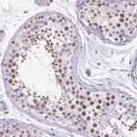 ZFP3 Antibody in Immunohistochemistry (Paraffin) (IHC (P))