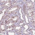ZFP3 Antibody in Immunohistochemistry (Paraffin) (IHC (P))