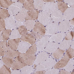 ZFP3 Polyclonal Antibody