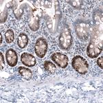 TRIP13 Antibody in Immunohistochemistry (Paraffin) (IHC (P))