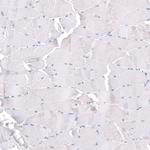 TRIP13 Antibody in Immunohistochemistry (Paraffin) (IHC (P))