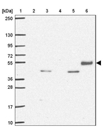 TSEN54 Antibody in Western Blot (WB)